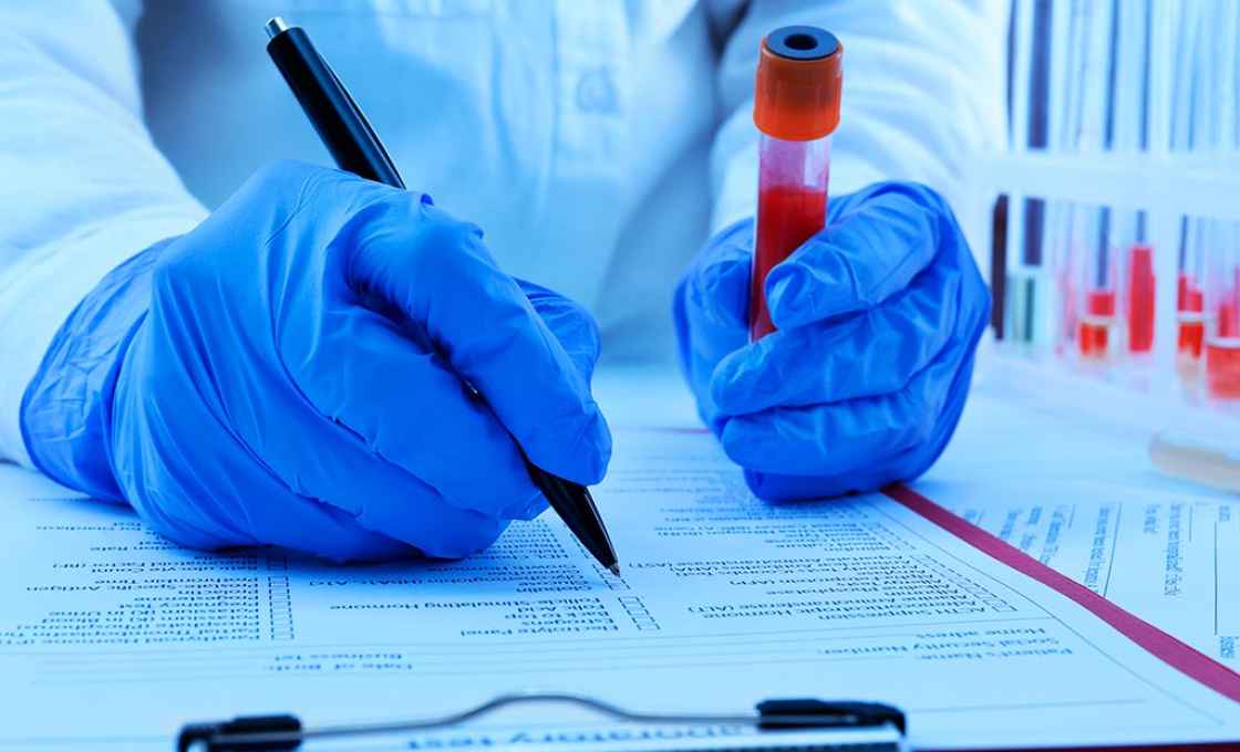 Сколько действителен анализ крови на ВИЧ