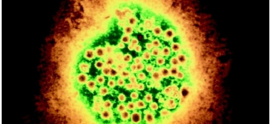 Новости про - Вирусный гепатит d, признаки, продолжительность жизни и как лечить?