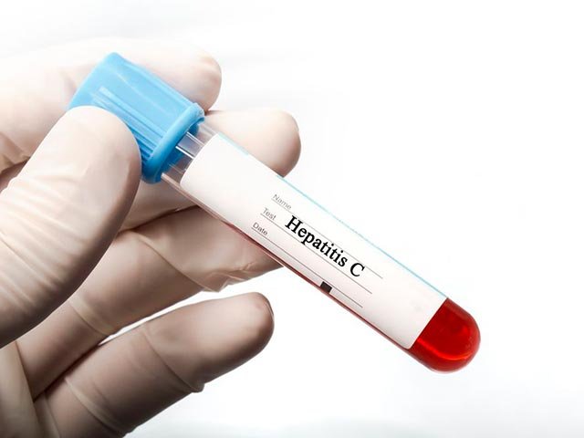 Новости про - Носитель гепатита С - что означает носительство при HCV, чем оно опасно