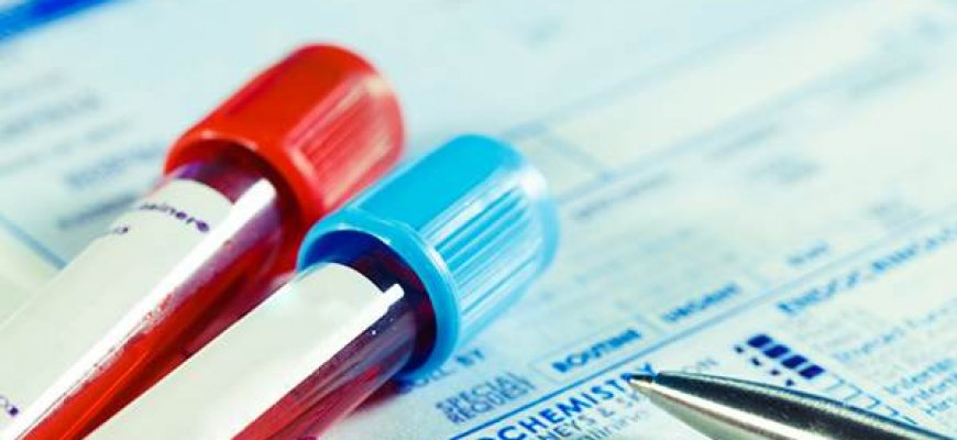 Новости про - Что такое ложноположительный результат на HCV и его причины?